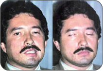 Caso 1