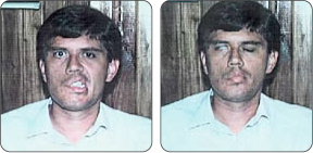 Caso 1